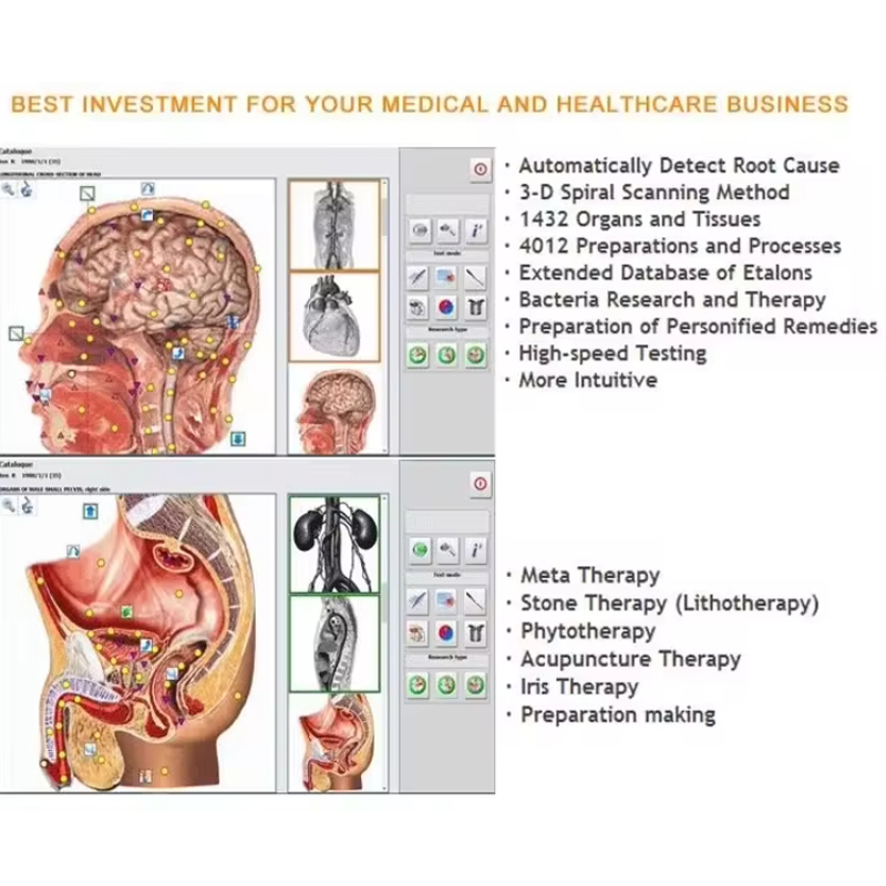 Metatron Hunter 4025 NLS Biore - Holistic Health & Wellness recensie en prijs