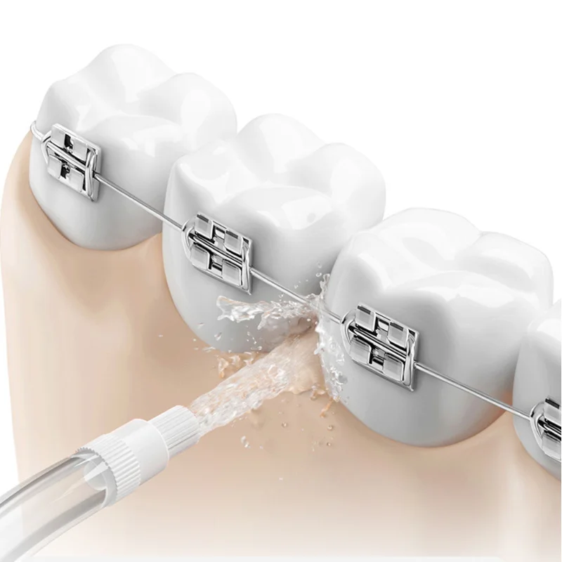 Originele mondstukken voor all - Oral Irrigator Flosser recensie en prijs